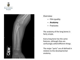 Ortholimb .